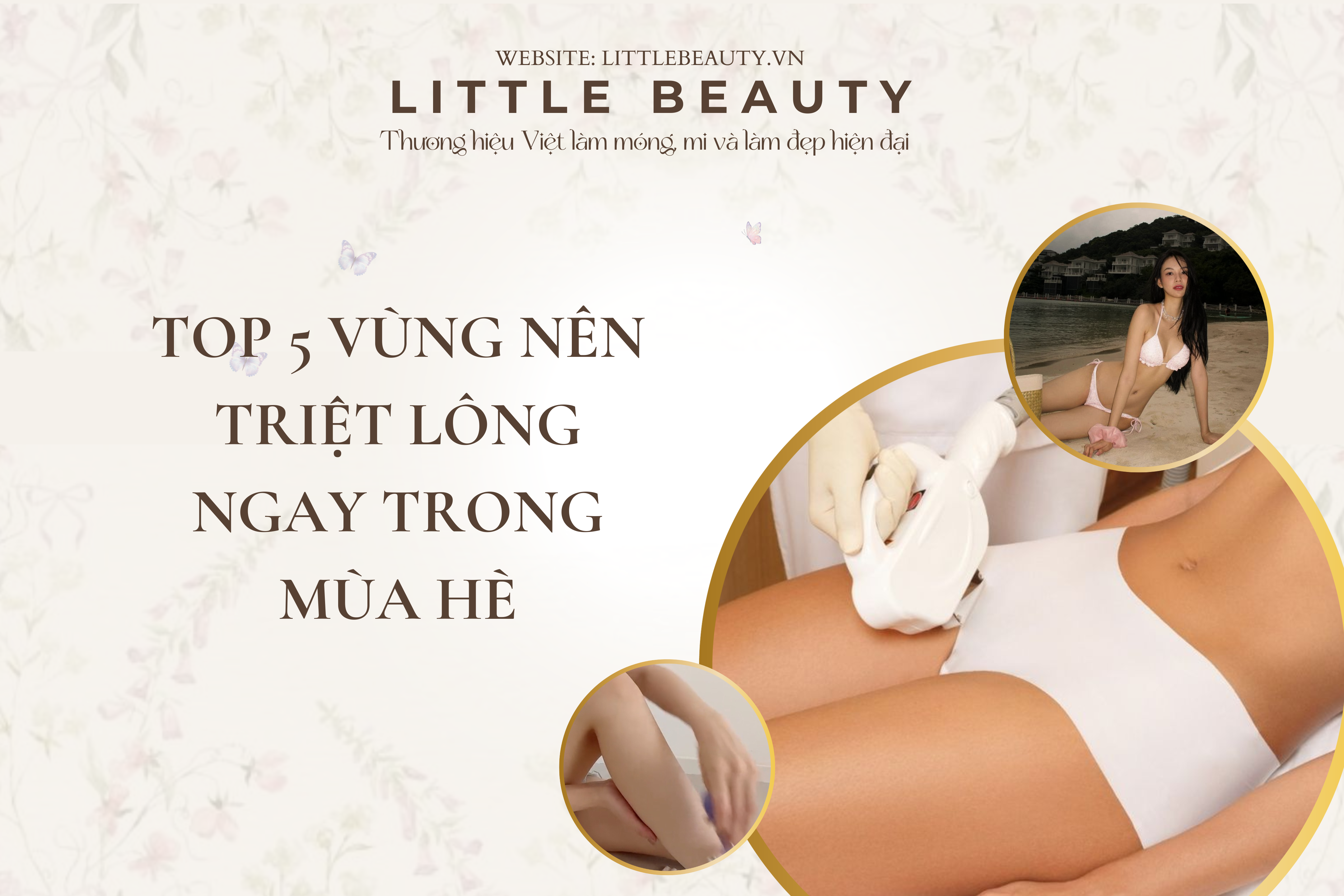Top 5 Vùng Nên Triệt Lông Ngay Trong Mùa Hè
